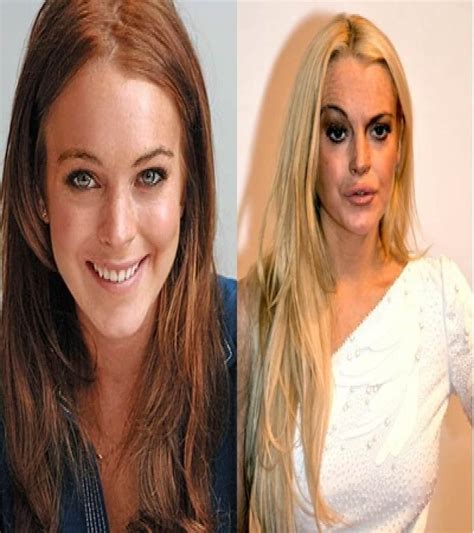 stars with bad plastic surgery